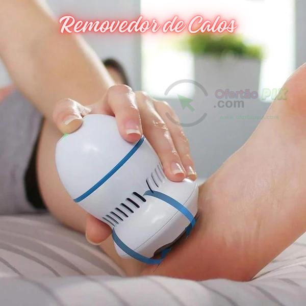 Removedor de calos e rachaduras Beauty Feet