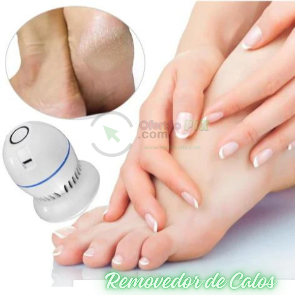 Removedor de calos e rachaduras Beauty Feet